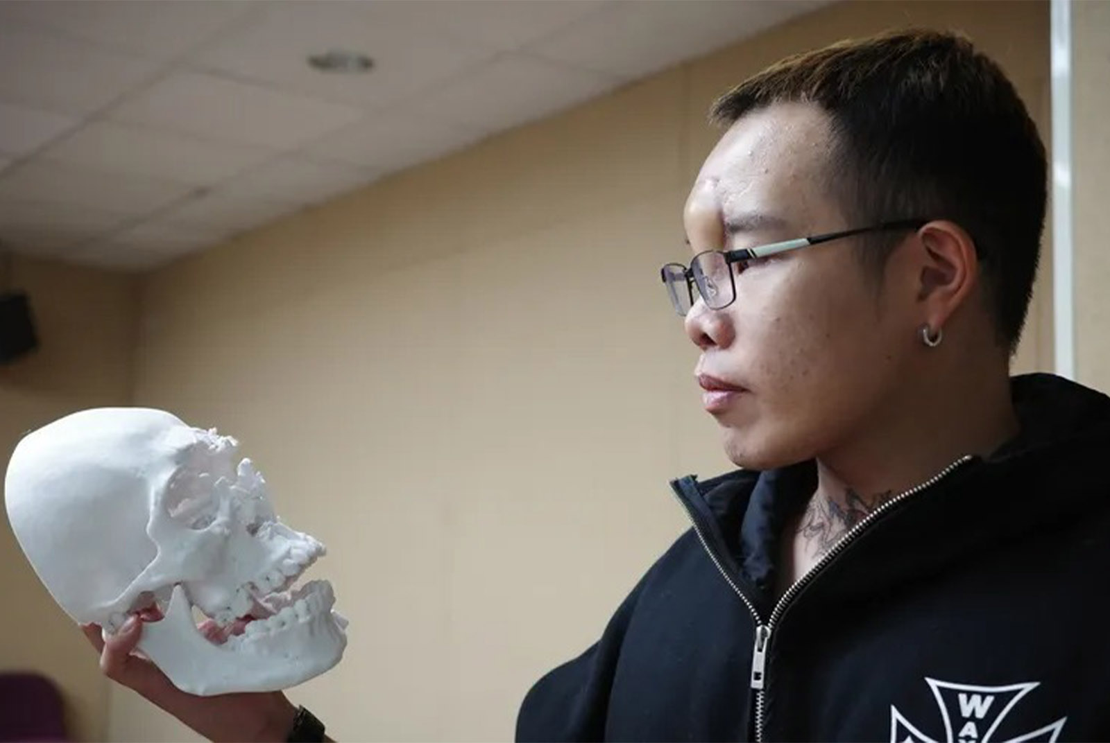 一槍轟碎半張臉，沒想過會活下來！三總為他修復的不只是臉，還有活著的意義
